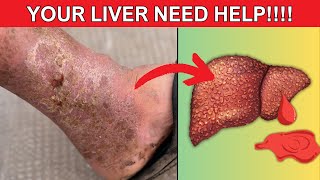 SHOCKING Liver Warning Signs Hiding in Your Feet (Don't Ignore These 12 Signs)