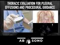 Thoracic evaluation for pleural effusions and procedural guidance