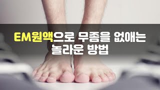 EM원액으로 무좀 치료하는 특급 비밀