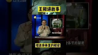 埋進身體裏的秘密【48】：女孩身患癲癇,神醫體內埋下彈簧...#懸疑 #懸疑故事 #shorts