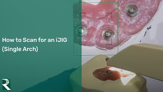 How to scan for an iJIG (single arch)