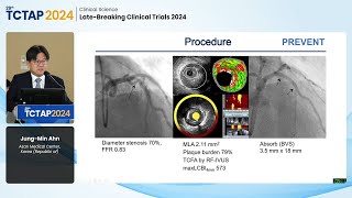 [TCTAP 2024] Clinical Science - Late-Breaking Clinical Trials 2024