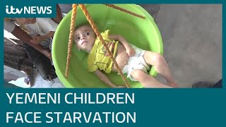 Yemeni conflict could cause 400,000 children under five to die from malnutrition | ITV News