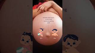 Twins: Boy Or Girl #shorts #shortvideo