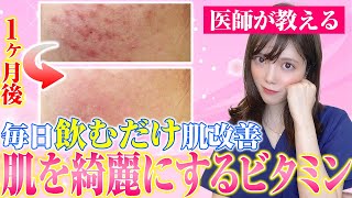 【女医が教える】飲むだけで 肌をきれいにする方法 ビタミンが与える肌への効果を解説します！【美肌スキンケア】