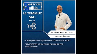 Dişlerin ve Çenelerin İdeal Kapanışı Nasıl Olmalıdır? Ortodontik Bozukluklar ve Tedavileri