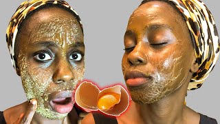 KIBOKO YA MAKUNYANZI | Most powerful mask to remove wrinkles, pigmentation, dark spots