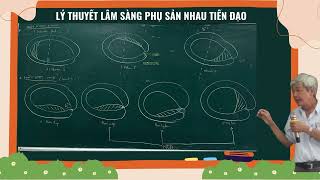 LÂM SÀNG SẢN CTUMP: LÝ THUYẾT LÂM SÀNG NHAU TIỀN ĐẠO