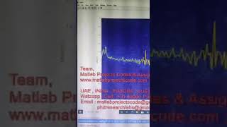 Apnea Detection using ECG - MATLAB - APNEA - SLEEP APNEA - ECG - MATLAB PROJECTS