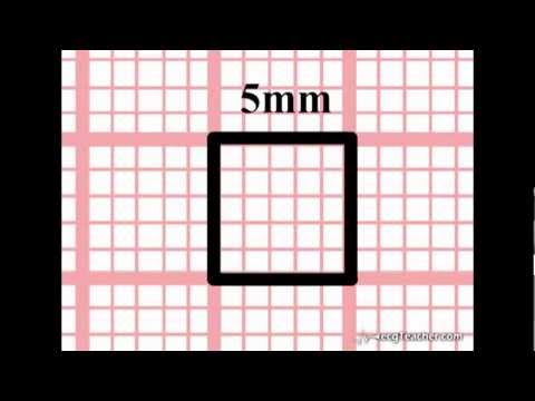 Acadoodle Time And The Ecg Section 1 5 Part 1 Youtube