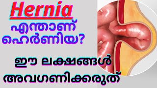 What is Hernia | Treatment for  Hernia in Malayalam