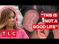 Daughters Are Being Bullied Because Of Their Mum's 8-Year-Old Cyst | Dr. Pimple Popper: This Is Zit!