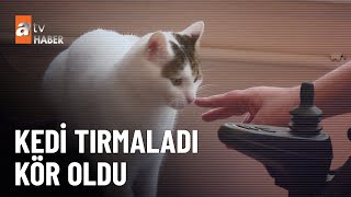 Kedi severken dünyası karardı - atv Ana Haber 30 Ocak 2025