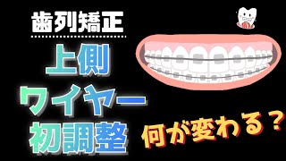 【歯列矯正】上側ワイヤーの1回目の調整をしてきたよ※写真出ますのでご注意！