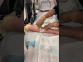 How to change a midline dressing