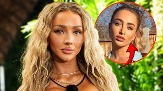 Love Island USA Star Vanna Einerson Opens Up About Plastic Surgery Rumor