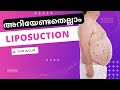 Liposuction | Liposuction Surgery | Body Fat Removal | Fat Reduction | Dr Prince Plastic surgeon