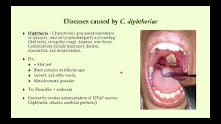 Corynebacterium diphtheriae (Diphtheria) - Microbiology Boot Camp