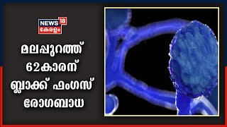 മലപ്പുറത്ത് 62കാരന് Black Fungus രോഗ ബാധയെ തുടർന്ന് കണ്ണ് നീക്കം ചെയ്തു; ചികിത്സാ ചെലവ് ലക്ഷങ്ങൾ