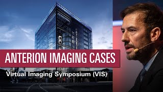 Imaging Quality of the ANTERION SS-OCT – Damien Gatinel | VIS 2020