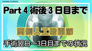 Part 4 ‐手術後3日目まで 【両足人工股関節置換術】