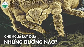 BỆNH GHẺ NGỨA LÂY QUA NHỮNG ĐƯỜNG NÀO ?