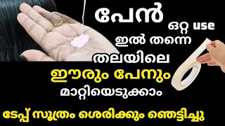 💯പേനും ഈരും ഒരു ദിവസം കൊണ്ട് പൂർണ്ണമായും മാറ്റം/Pen salyam maram #liceremoval #headlice #lice