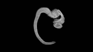 Human Embryo (day 41), neural tube - MRI