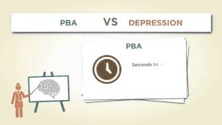 Pseudobulbar Affect and Stroke