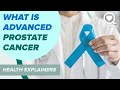 What Is Advanced Prostate Cancer | Health Explainers | Sharecare