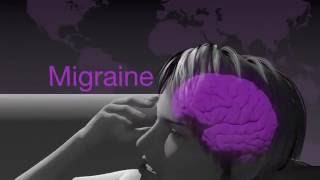 Demystifying Migraine