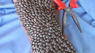 We Help Cleaning Million Big Ticks on Knee Man With Pliers That Work 100% #752