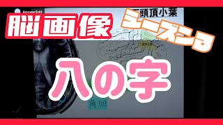 [理学療法士]脳画像シリーズ　八の字レベル編