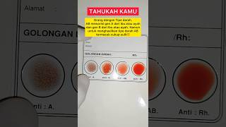 Darah Bule‼️Fakta dan Penampakan Golongan Darah AB- #shorts