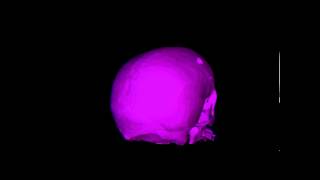 skull - stereo