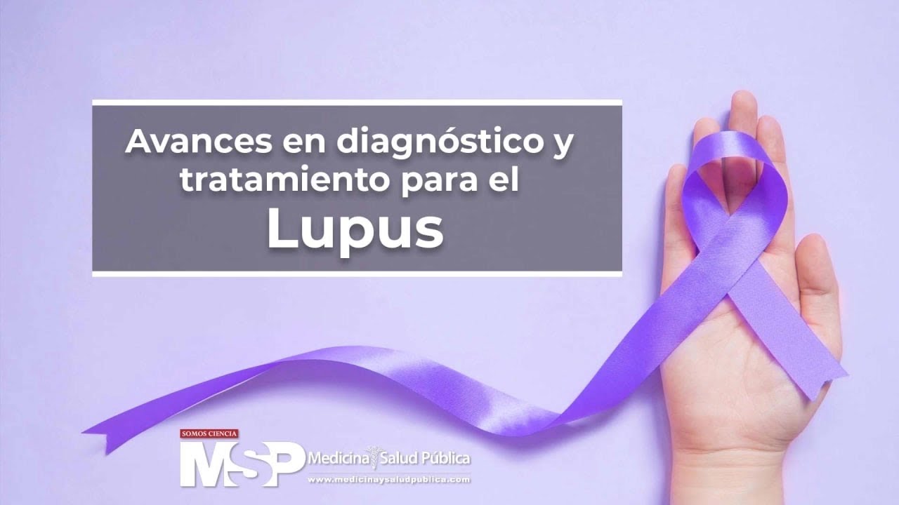 Tratamiento Para El Lupus