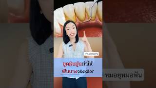 ขูดหินปูนทำให้ฟันบางจริงหรือ ? #หินปูน #คราบหินปูน #การขูดหินปูน #เหงือกอักเสบ