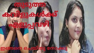 തുടുത്ത കവിളുകൾക്ക് / How to get chubby cheeks in malayalam/ malayalam/ എത്ര ഒട്ടിയ കവിളും തുടുക്കും