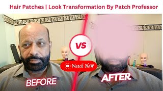 Hair patches For Men | Look Transformation By Patch Professor|