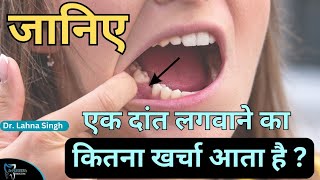 cost of 1 missing tooth || एक दांत का खर्चा || Dr. Lahna Singh