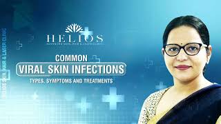 Common Viral Skin Infections | Types, Symptoms and Treatments