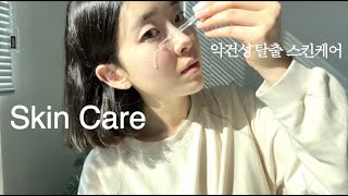 건성피부도 광나는 그날까지, 악건성 스킨케어 / Skin care routine for bad dry skin