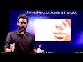 നിങ്ങൾക് ഈ 5 ചർമ്മ രോഗങ്ങളിൽ ഏതെങ്കിലും ഒന്ന് ഉണ്ടോ എങ്കിൽ വില്ലൻ നിങ്ങളുടെ തൈറോയ്ഡ് ആവാം