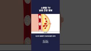 진성여유증은 수술적 치료가 필요합니다