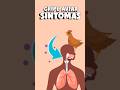 ¡Cuidado! Gripe aviar en humanos, ¿cuáles son los síntomas? #shorts