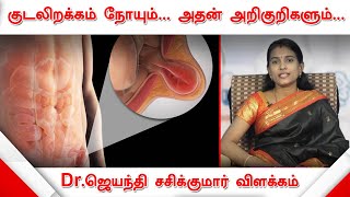 குடலிறக்கம் நோயும்... அதன் அறிகுறிகளும்... | Hernia | மருத்துவர் ஜெயந்தி சசிக்குமார் | Health Tips