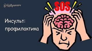 Узнайте за 5 МИНУТ, как избежать Инсульт. Советы опытного невролога.