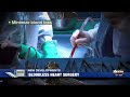 medical moment bloodless heart surgery