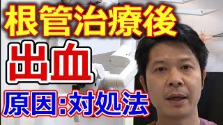 根管治療後に出血した時の原因と対処方法【千葉市中央区の歯医者】