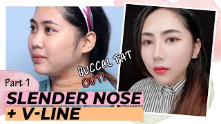 [SUB] BEAUTY TRANSFORMATION VLOG | RHINOPLASTY WITH FACIAL LIPOSUCTION SURGERY | BEFORE \u0026 AFTER VLOG